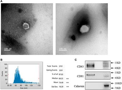 Exosome-Derived LncRNA TCONS_00072128 Mediated Osteogenic Differentiation and Inflammation by Caspase 8 Regulation